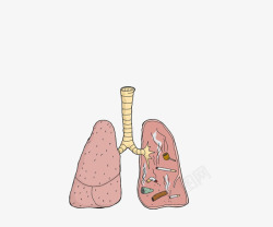 卡通漫画吸烟者的肺素材
