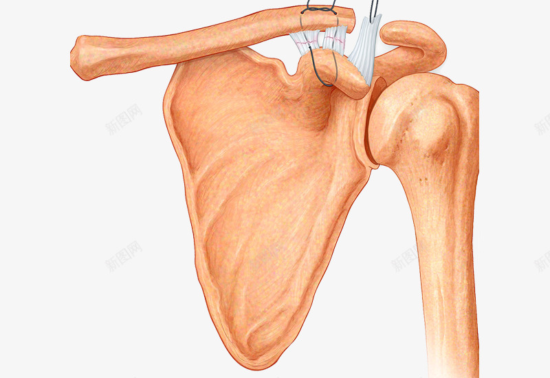 韧带拉伤展示图png免抠素材_新图网 https://ixintu.com 人体骨骼 免抠 医生诊治 治疗康复 膝盖韧带 运动损伤