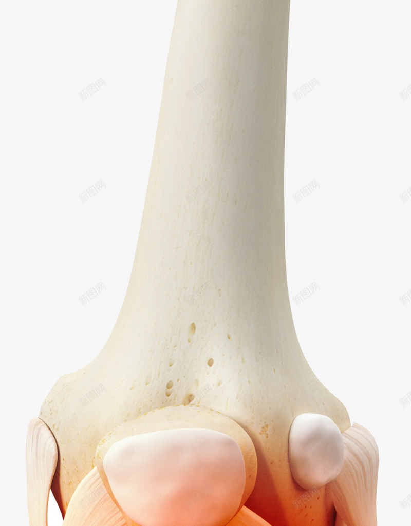 膝盖骨头炎症png免抠素材_新图网 https://ixintu.com 拼接处 红肿发炎 膝盖 膝盖骨头红肿发炎 骨头