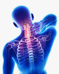 PNG骨骼人体颈椎疼痛高清图片