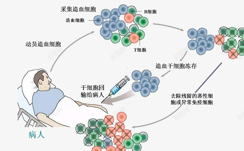 干细胞移植技术psd免抠素材_新图网 https://ixintu.com 干细胞 移植 肿瘤 造血干细胞