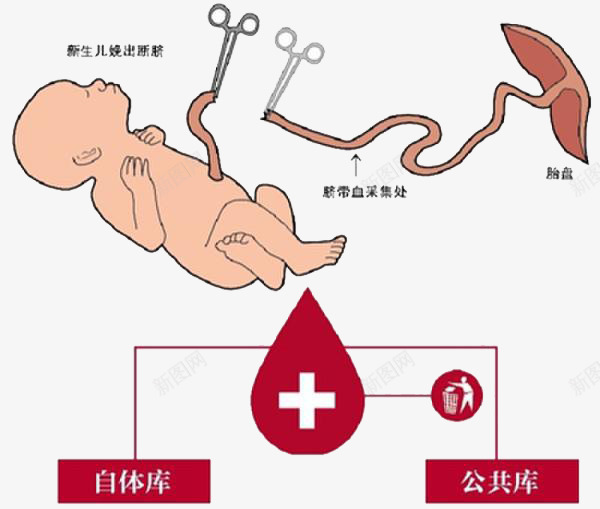 剪掉婴儿脐带png免抠素材_新图网 https://ixintu.com 出生 剪刀 剪掉 婴儿 宝宝 小娃娃 新生儿 母婴 胎儿 胚胎 脐带 脐带血 诞生 降临