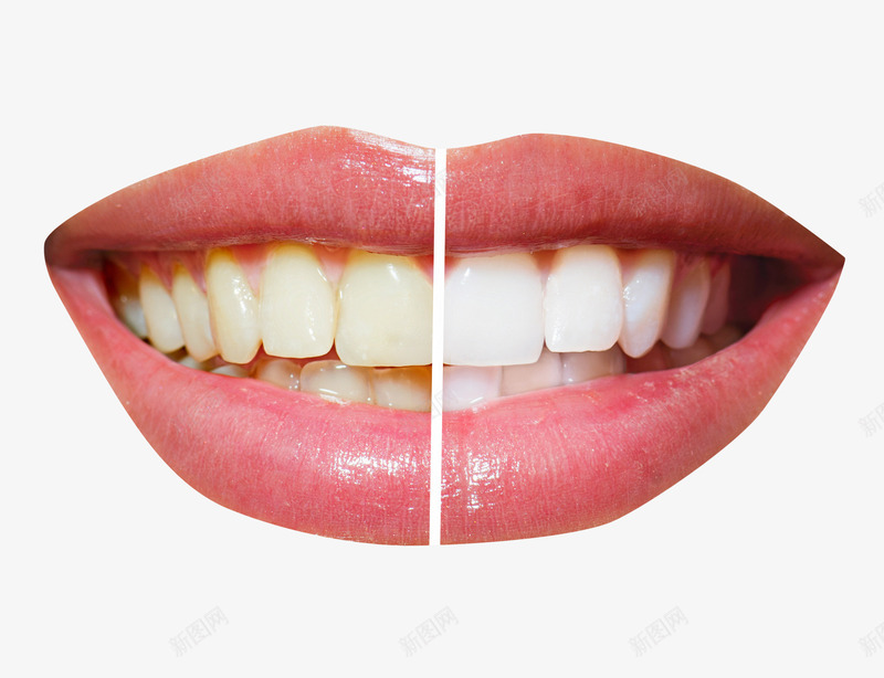 黄牙白牙对比png免抠素材_新图网 https://ixintu.com 对比 开口 开口笑 开口笑的牙 洁白牙齿 洁白的牙 牙齿 黄牙