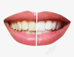 洁白的牙黄牙白牙对比高清图片
