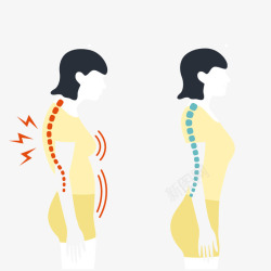 矢量嵴柱女性脊骨损伤高清图片