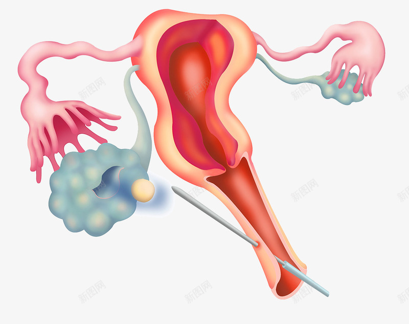 生殖系统医疗插图png免抠素材_新图网 https://ixintu.com 发育 受精卵 子宫 生殖系统 输卵管