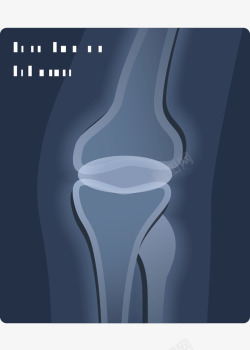 脚部的x光片图片医疗X光片标矢量图图标高清图片
