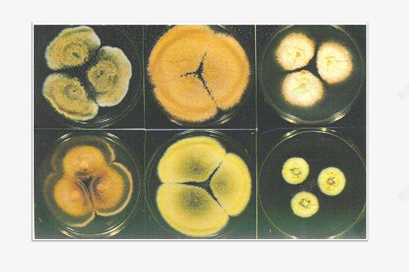 酵母菌png免抠素材_新图网 https://ixintu.com 实物 微生物 酵母菌