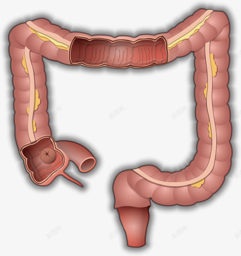 肠子元素png免抠素材_新图网 https://ixintu.com png 元素 卡通 器官 生物医药 肠子