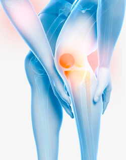 膝盖关节炎医疗插图素材