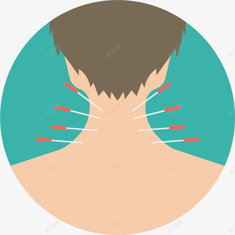 颈部卡通针灸矢量图eps免抠素材_新图网 https://ixintu.com 中医 中国针灸 卡通 扁平风格 针灸疗法 颈部 颈部针灸 矢量图