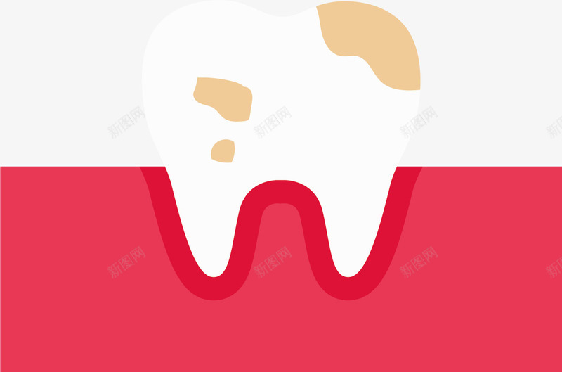 牙床上的蛀牙矢量图图标ai_新图网 https://ixintu.com 图标icon 牙床 牙齿 蛀牙 龋齿 矢量图