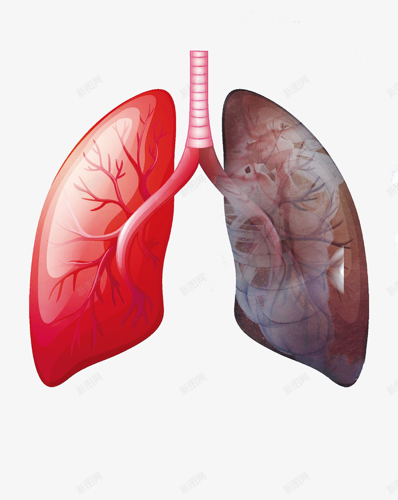 创意被污染的肺png免抠素材_新图网 https://ixintu.com 健康 公益广告 创意设计 插画 污染 癌症 肺