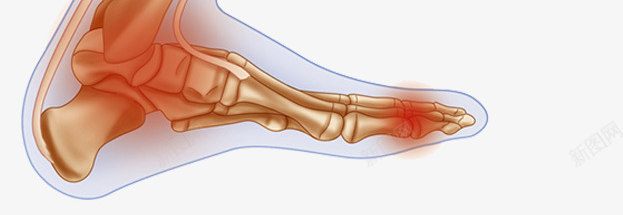 膝盖软骨结构插画png免抠素材_新图网 https://ixintu.com 关节炎 小腿 肌肉 软骨