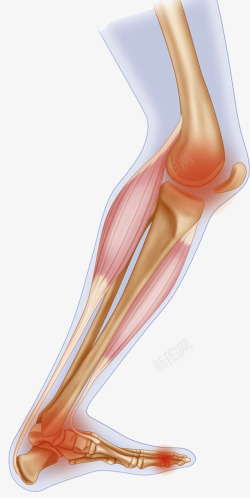 关节炎膝盖软骨结构插画高清图片