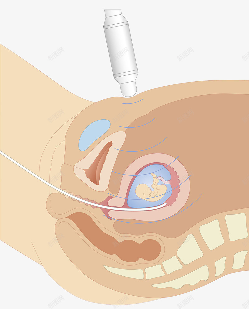 超声波胚胎探测png免抠素材_新图网 https://ixintu.com 人体结构 探测 生殖器官 生物科技 胚胎 超声波 输卵管
