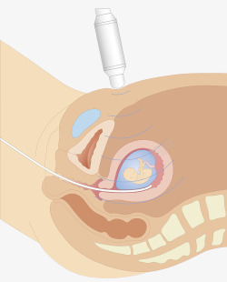 声波探测超声波胚胎探测高清图片