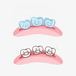 牙齿矫正免抠PNG卡通可爱矫正牙齿两种牙套插画免高清图片