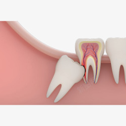 立体图示卡通立体牙齿智齿牙痛高清图片