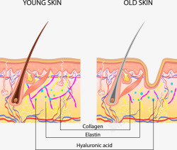 面部装饰年轻人皮肤和老年人皮肤结构对比矢量图高清图片