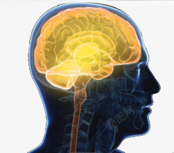 嵴髓灰质炎人体大脑系统示意图侧面高清图片