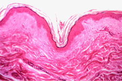 皮层组织皮肤组织化验高清图片