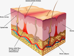 人体皮肤人体皮肤结构分析图高清图片