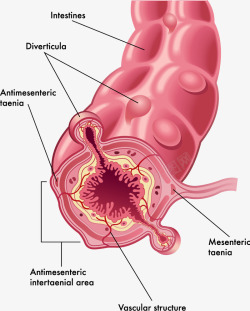 人体肠道人体大肠结构分析图高清图片