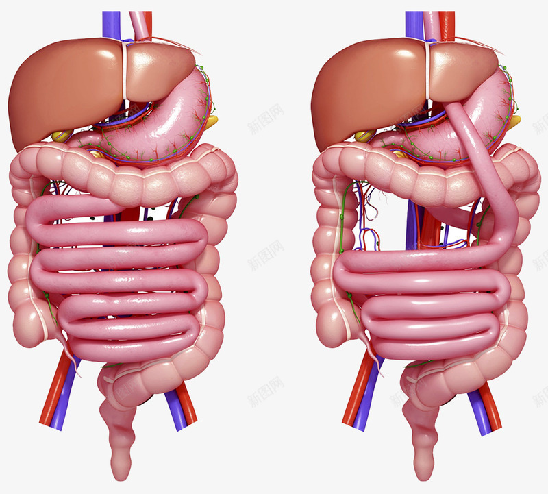 人体胃部器官psd免抠素材_新图网 https://ixintu.com 人体器官 十二指肠 对比图 病变 胃肠