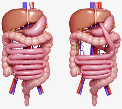 病变人体胃部器官高清图片