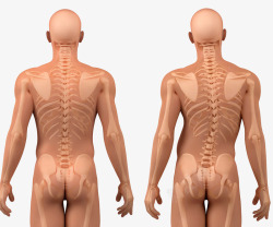 腰椎畸形对比图素材