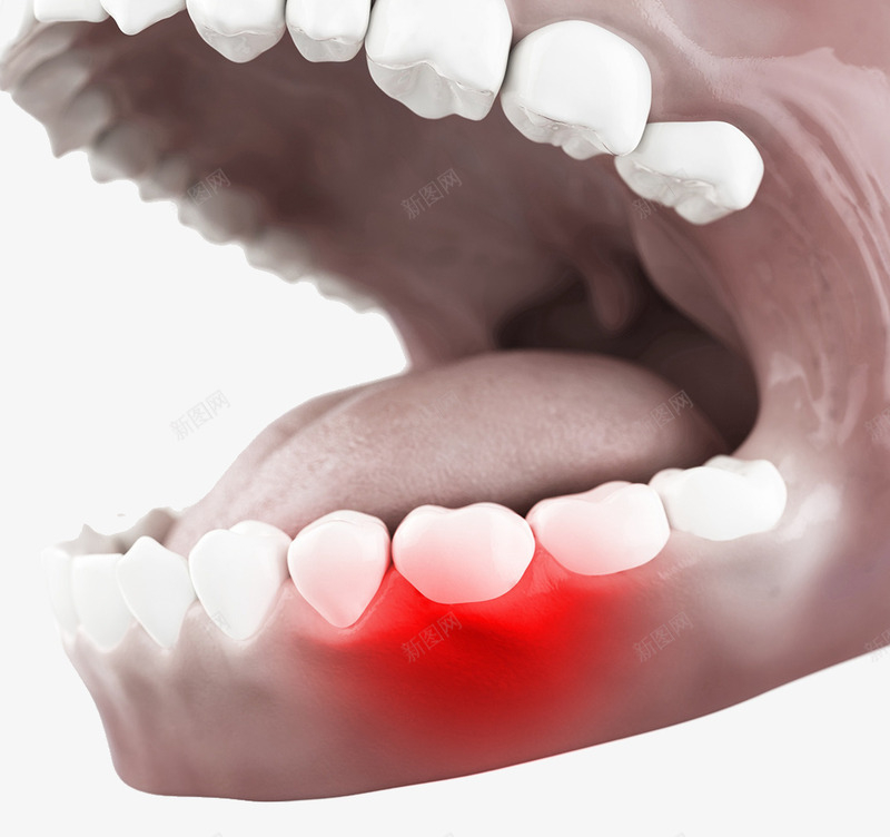 牙肉肿痛效果图png免抠素材_新图网 https://ixintu.com 人体结构 插画 牙医 牙疼 牙肉肿痛