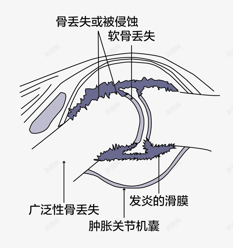 人体骨关节效果图png免抠素材_新图网 https://ixintu.com 人体关节 免抠图 效果图 文字 装饰画 骨关节