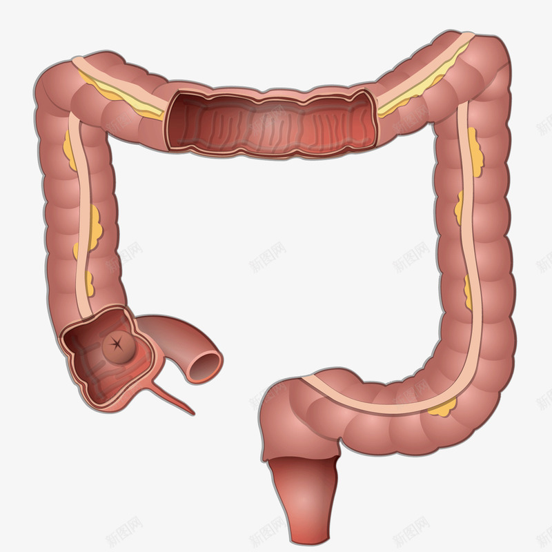 红色肠道png免抠素材_新图网 https://ixintu.com 健康 医疗 素材 肠道