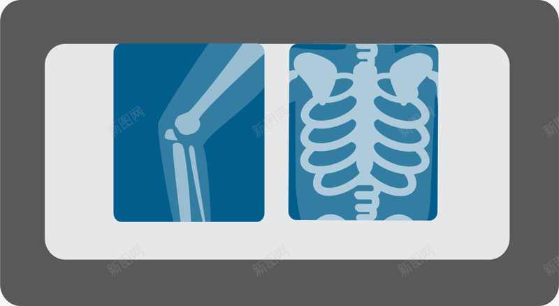 蓝色医院拍片png免抠素材_新图网 https://ixintu.com X光 健康 医院 拍X光线 拍片检查 检查 蓝色拍片 装饰图案 骨头