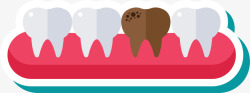 牙床龋齿素材