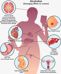 女性身体部位伤害影响分析图素材
