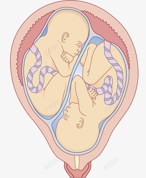 双胞胚胎png免抠素材_新图网 https://ixintu.com 共一个子宫 双胞胎 同卵双胞胎 宝宝 胚胎 长大