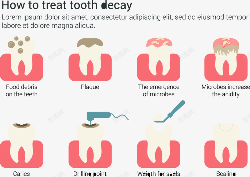 如何治疗龋齿信息图表png免抠素材_新图网 https://ixintu.com PPT图片 个性元素 创意信息图表 治疗龋齿图示 牙齿图片