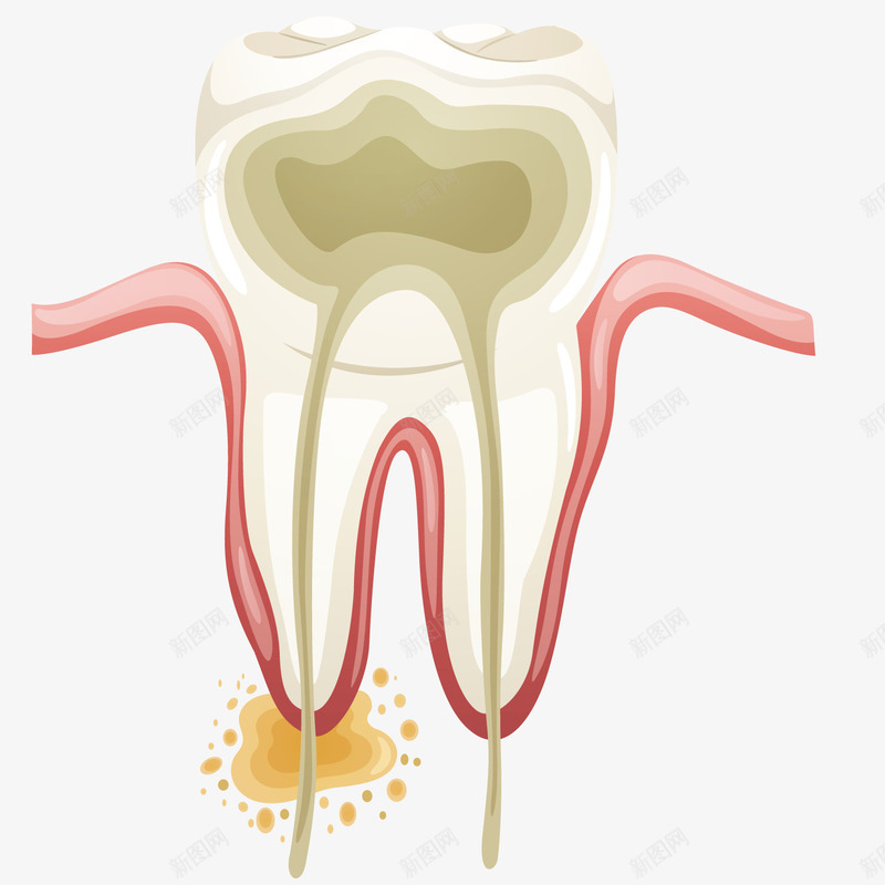 手绘牙齿png免抠素材_新图网 https://ixintu.com 医学研究 绘画装饰 蛀牙 观察 齿根