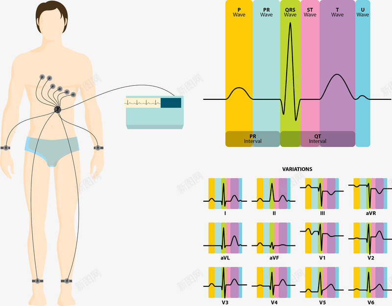 心电图矢量图ai免抠素材_新图网 https://ixintu.com 体检 医院检查 心电图 身体健康 身体检查 矢量图