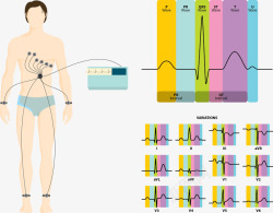 医院检查心电图矢量图高清图片