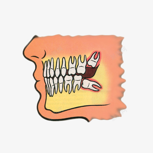 卡通手绘头像智齿插画png免抠素材_新图网 https://ixintu.com 卡通 头像 手绘 插图 智齿 牙痛 牙齿 配图