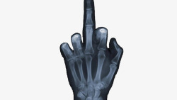手掌骨骼X光照片高清图片